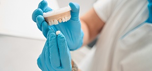 dental holding a model dental crown and arch