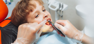 kid having a front tooth extracted